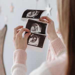 4 Common Choice Arguments (Part 3) - When Does Life Begin?