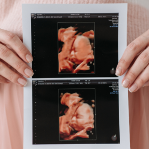 5 Things Babies Can Do Before Birth - When Does Life Begin?